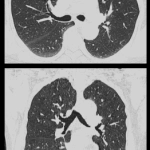 uCT960+ 640-slice CT