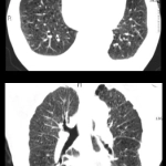 uCT960+ 640-slice CT