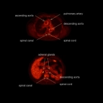 uEXPLORER | Total-body PET/CT