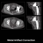 uMI 550 | Digital High-Resolution PET/CT
