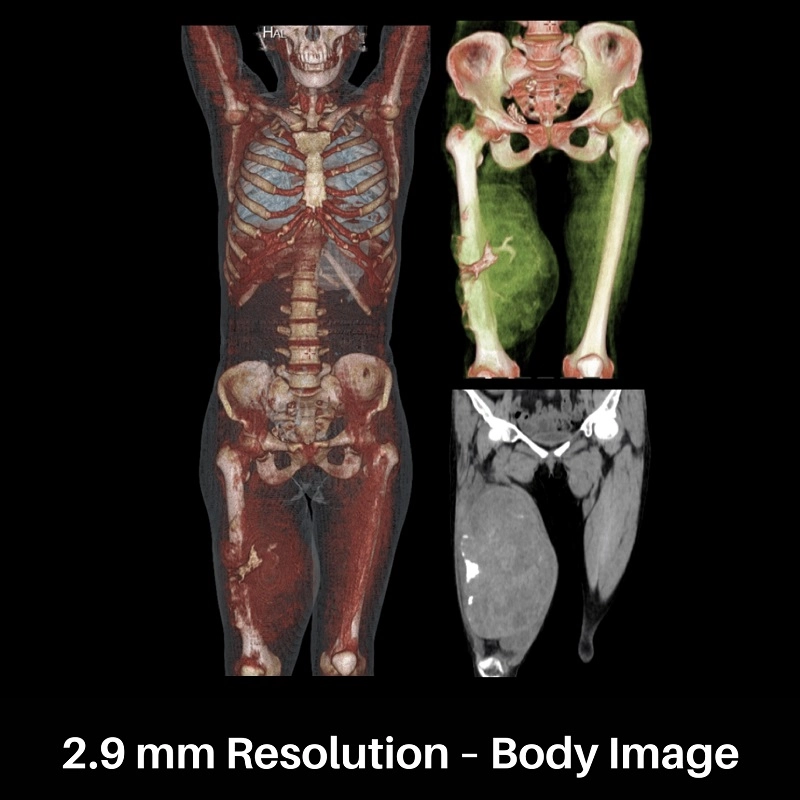uMI 550 | Digital High-Resolution PET/CT