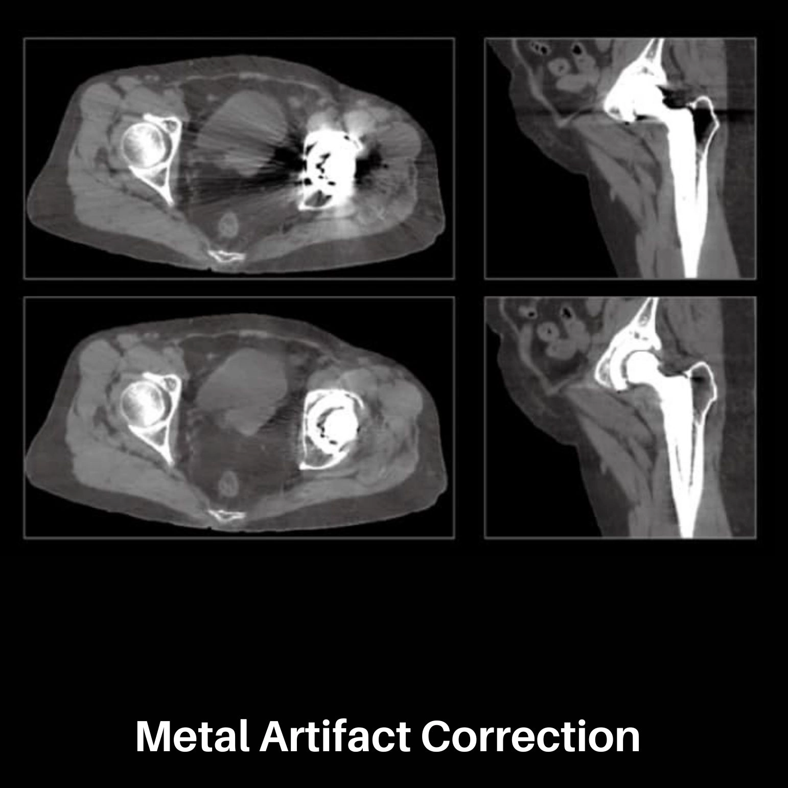 uMI 550 | Digital High-Resolution PET/CT
