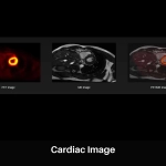 uPMR 790 | HD TOF PET/MR
