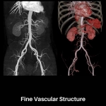 uMI 550 | Digital High-Resolution PET/CT