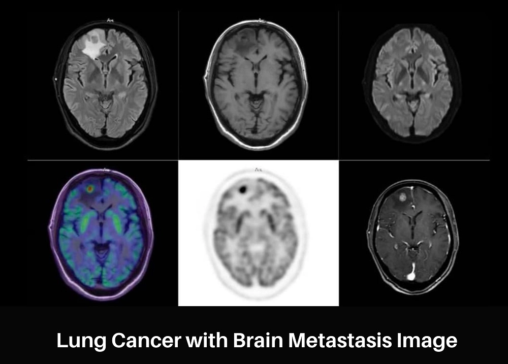 uPMR 790 | HD TOF PET/MR