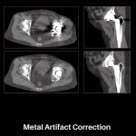 uMI 550 | Digital High-Resolution PET/CT