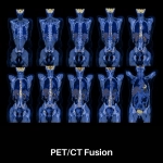 uMI 550 | Digital High-Resolution PET/CT