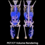 uMI 550 | Digital High-Resolution PET/CT