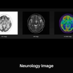 uPMR 790 | HD TOF PET/MR