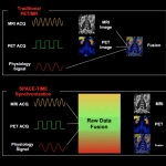 uPMR 790 | HD TOF PET/MR
