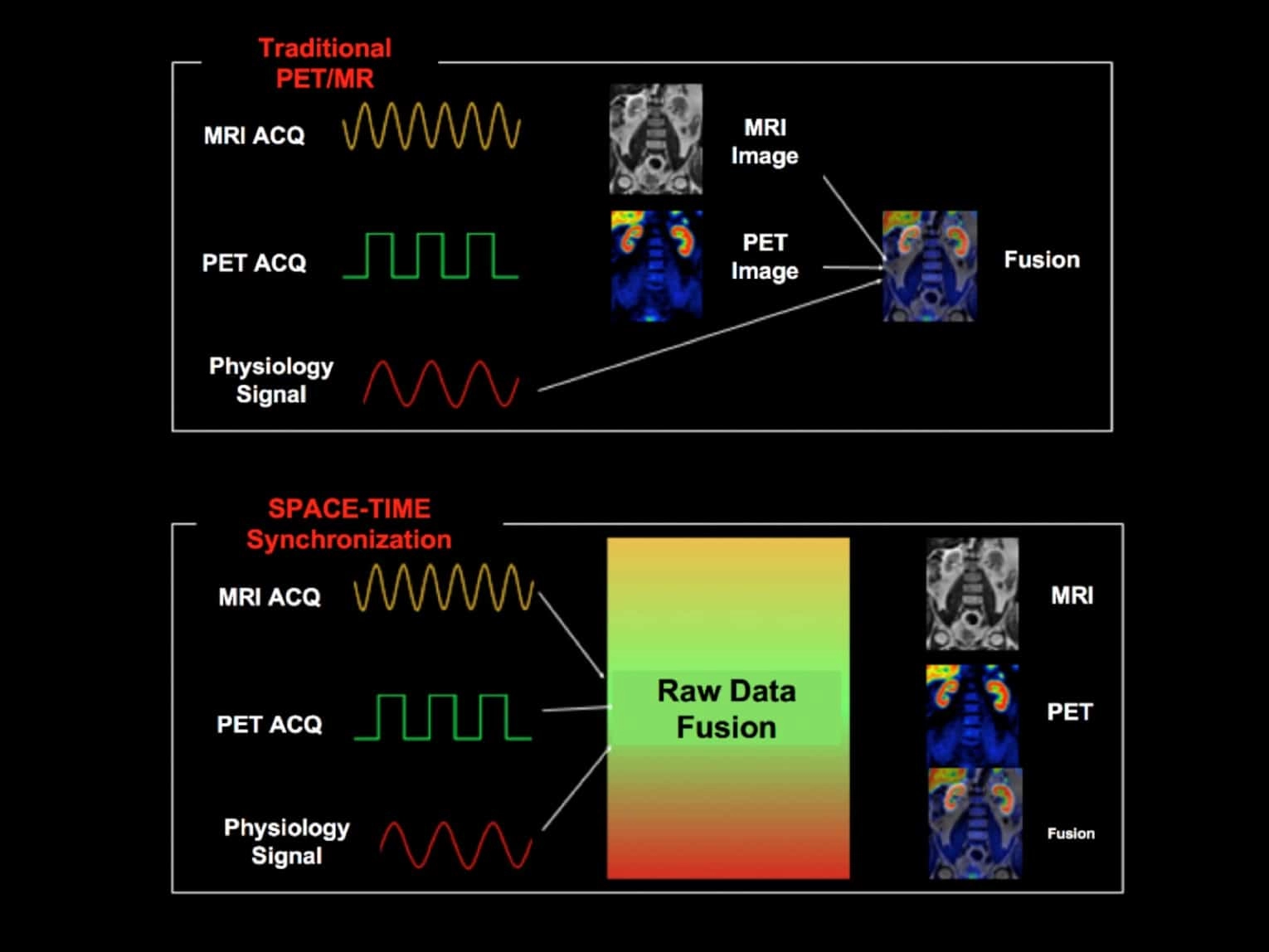 uPMR 790 | HD TOF PET/MR