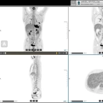 uMI 550 | Digital High-Resolution PET/CT