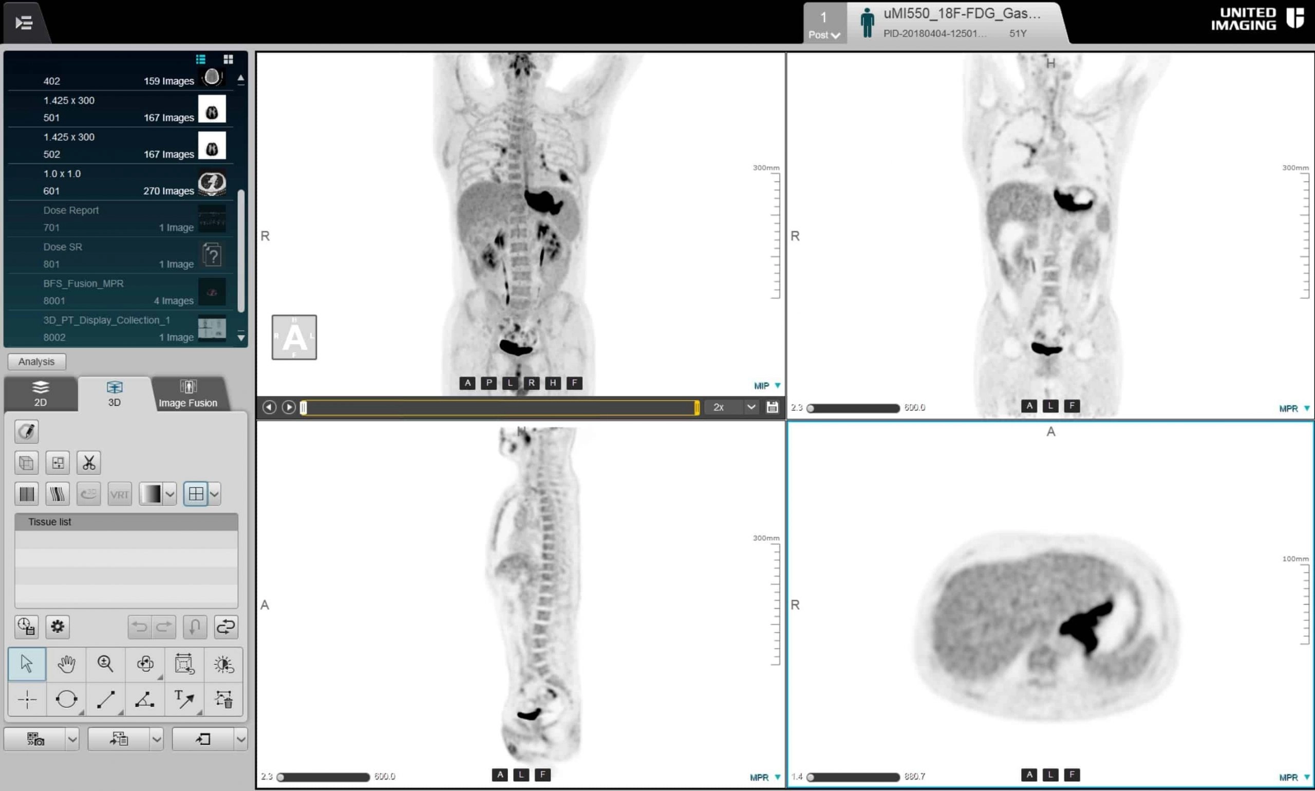 uMI 550 | Digital High-Resolution PET/CT