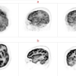 uMI 780 | Ultra-Fast High-Resolution Digital PET/CT