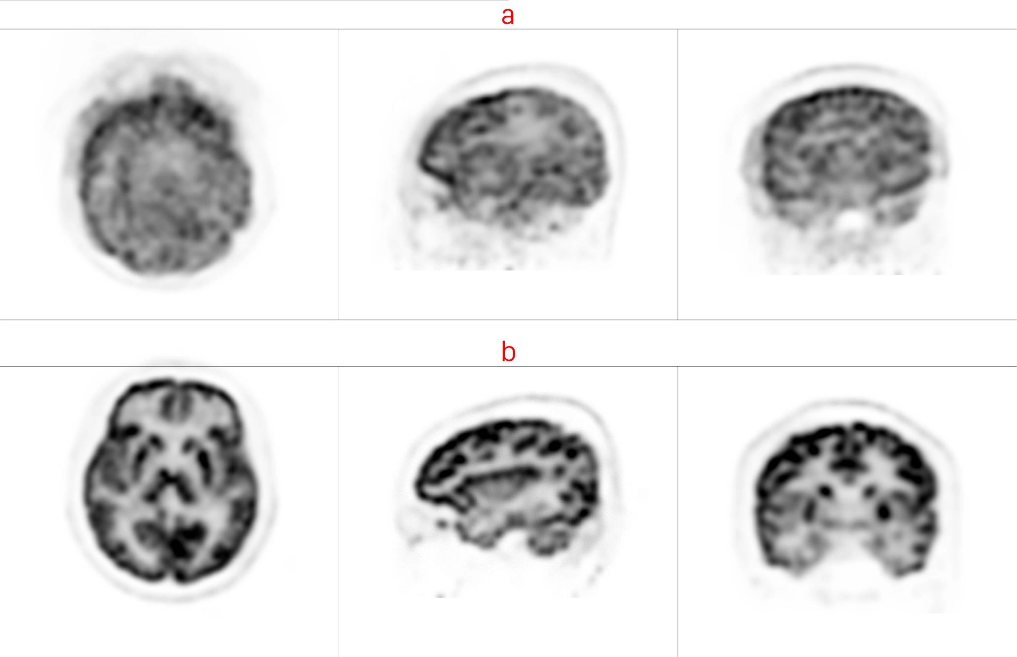 uMI 780 | Ultra-Fast High-Resolution Digital PET/CT