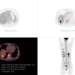 uMI 780 | Ultra-Fast High-Resolution Digital PET/CT