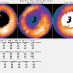 uMI 780 | Ultra-Fast High-Resolution Digital PET/CT