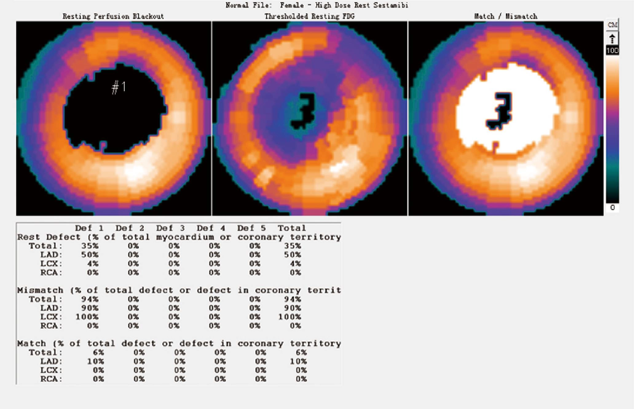 uMI 780 | Ultra-Fast High-Resolution Digital PET/CT