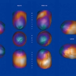 uMI 780 | Ultra-Fast High-Resolution Digital PET/CT