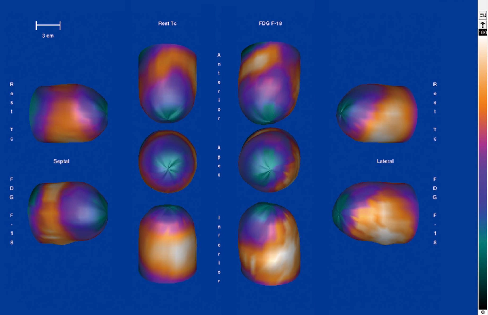 uMI 780 | Ultra-Fast High-Resolution Digital PET/CT