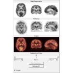 uMI 780 | Ultra-Fast High-Resolution Digital PET/CT