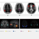 uMI 780 | Ultra-Fast High-Resolution Digital PET/CT