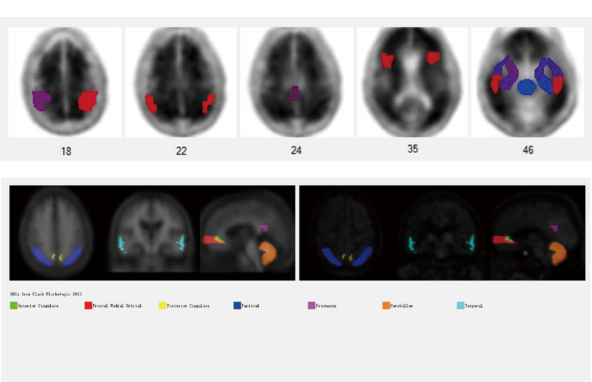 uMI 780 | Ultra-Fast High-Resolution Digital PET/CT