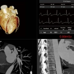 uMI 780 | Ultra-Fast High-Resolution Digital PET/CT
