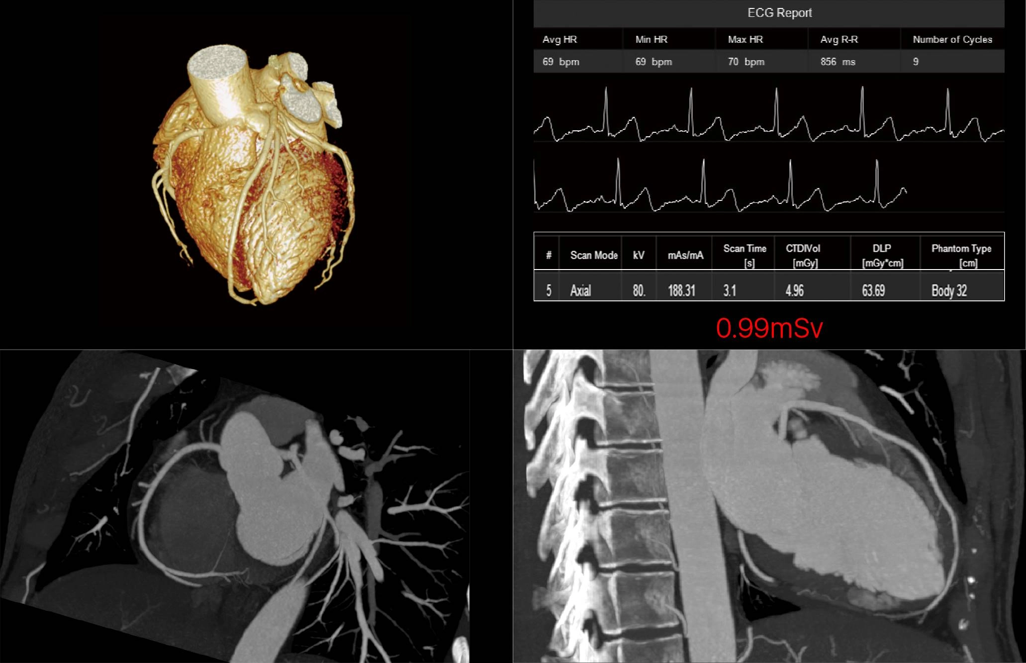 uMI 780 | Ultra-Fast High-Resolution Digital PET/CT