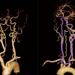 uMI 780 | Ultra-Fast High-Resolution Digital PET/CT