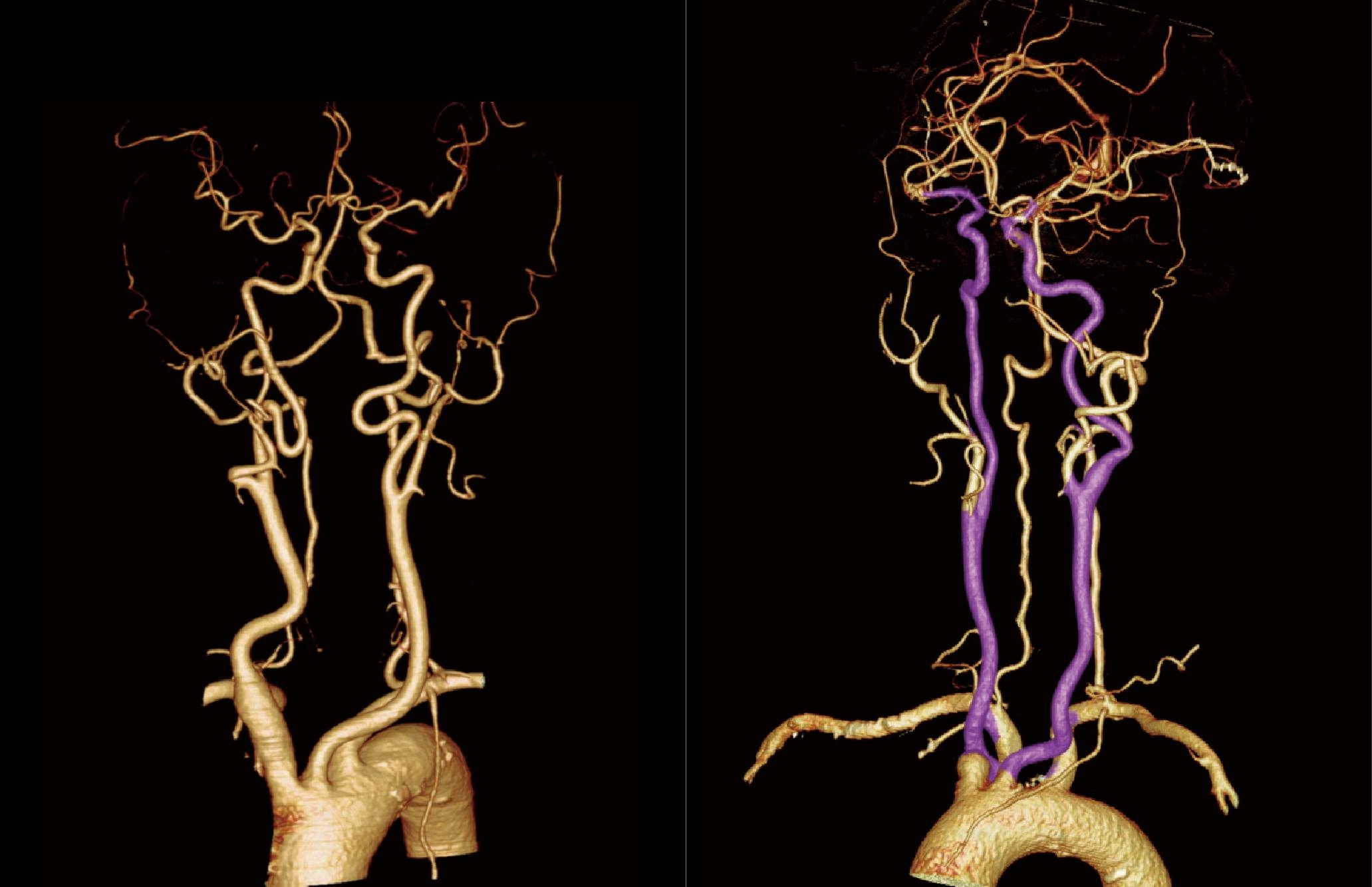 uMI 780 | Ultra-Fast High-Resolution Digital PET/CT