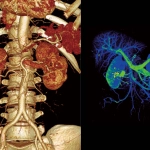 uMI 780 | Ultra-Fast High-Resolution Digital PET/CT