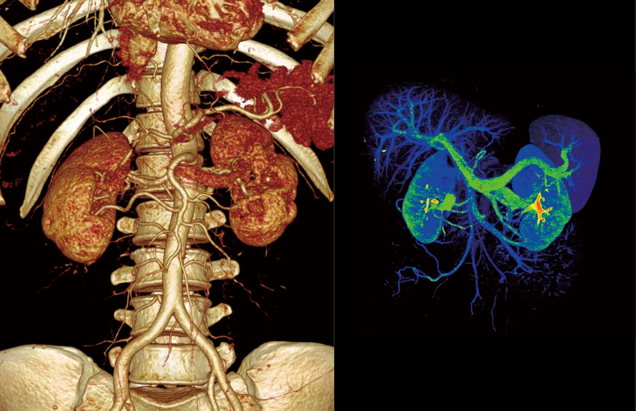 uMI 780 | Ultra-Fast High-Resolution Digital PET/CT