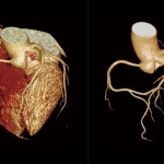 uMI 780 | Ultra-Fast High-Resolution Digital PET/CT