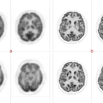 uMI 780 | Ultra-Fast High-Resolution Digital PET/CT