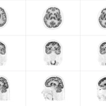 uMI 780 | Ultra-Fast High-Resolution Digital PET/CT