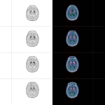 uMI 780 | Ultra-Fast High-Resolution Digital PET/CT