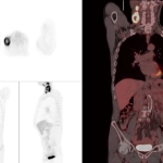uMI 780 | Ultra-Fast High-Resolution Digital PET/CT