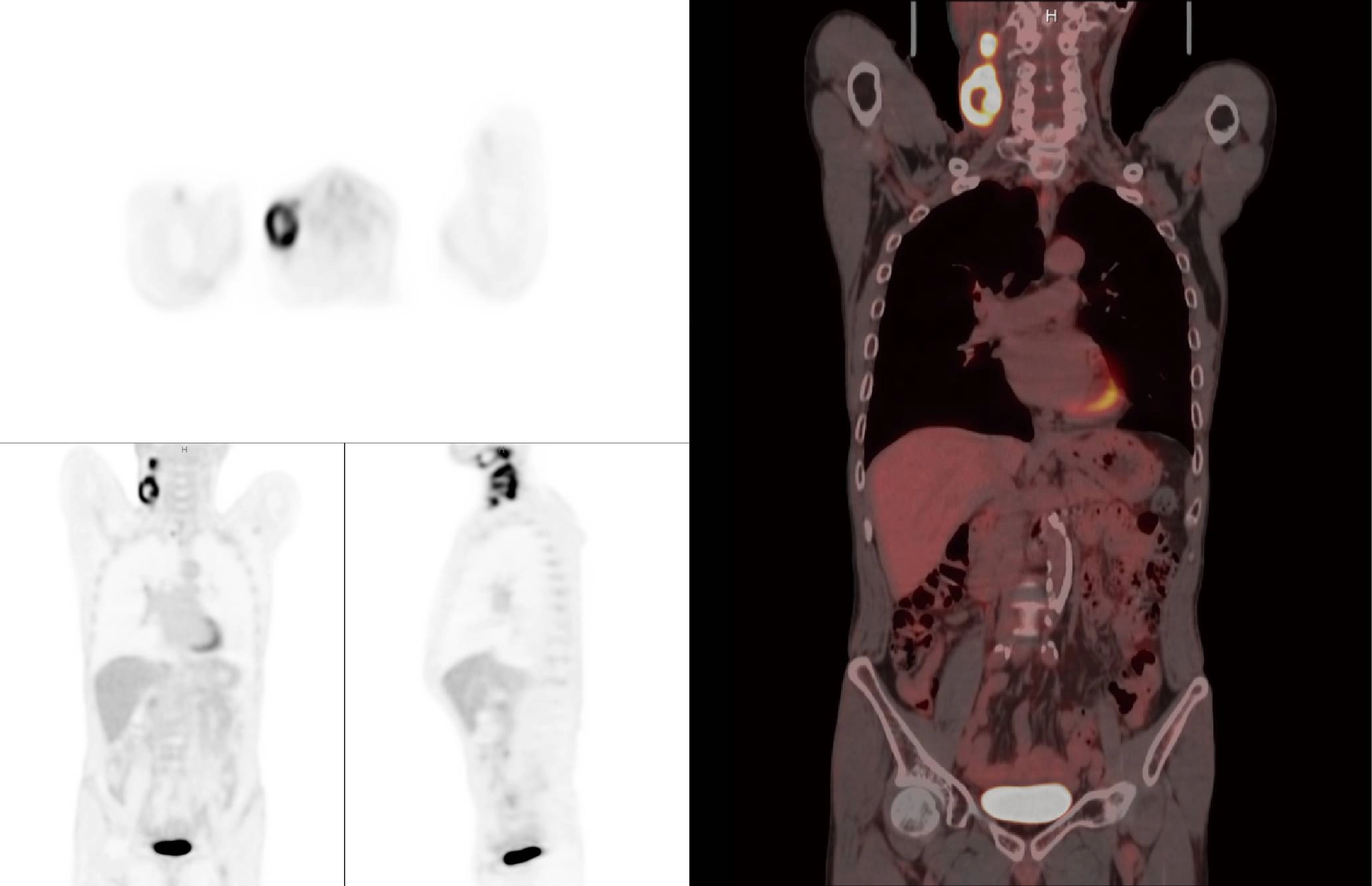 uMI 780 | Ultra-Fast High-Resolution Digital PET/CT