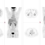 uMI 780 | Ultra-Fast High-Resolution Digital PET/CT
