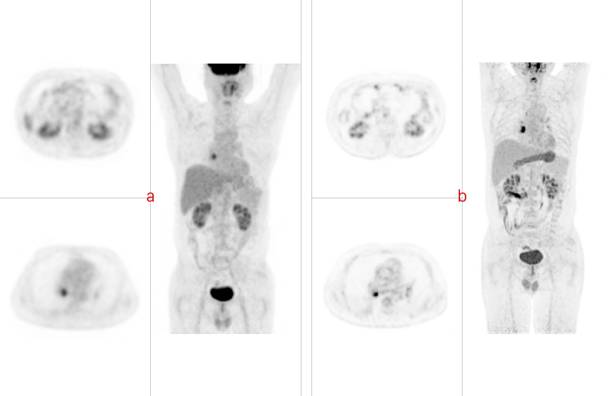 uMI 780 | Ultra-Fast High-Resolution Digital PET/CT