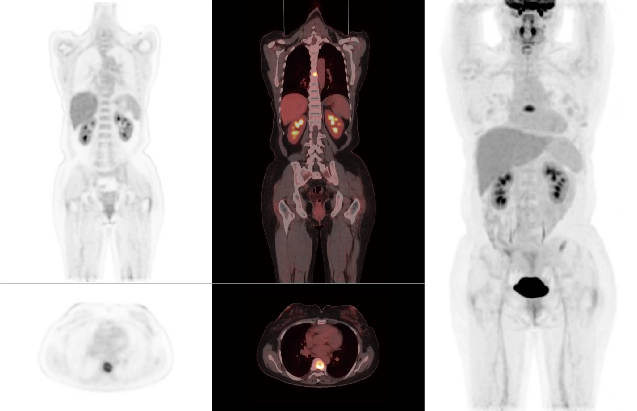 uMI 780 | Ultra-Fast High-Resolution Digital PET/CT