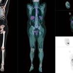 uMI 780 | Ultra-Fast High-Resolution Digital PET/CT