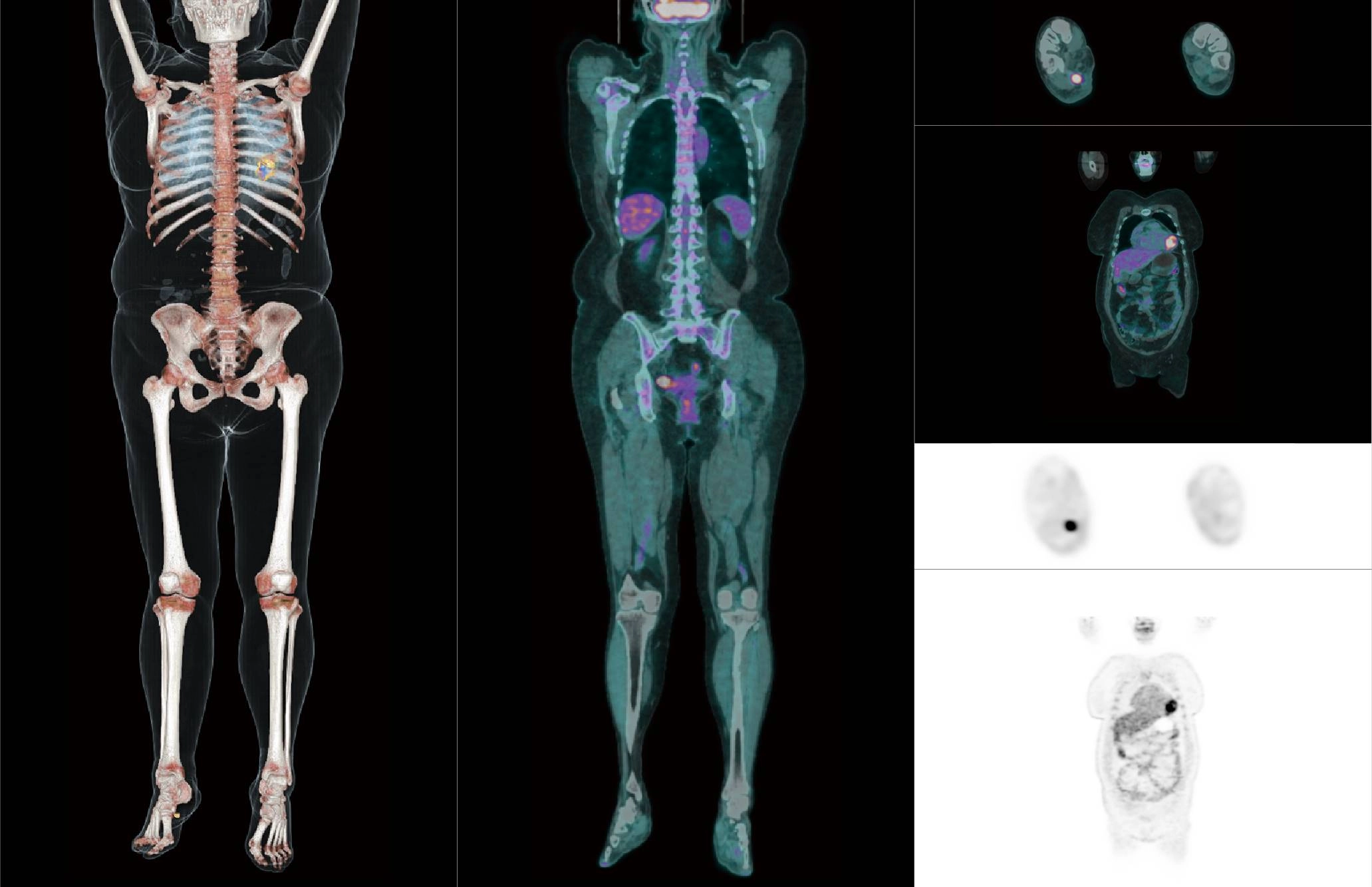 uMI 780 | Ultra-Fast High-Resolution Digital PET/CT