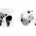 uMI 780 | Ultra-Fast High-Resolution Digital PET/CT