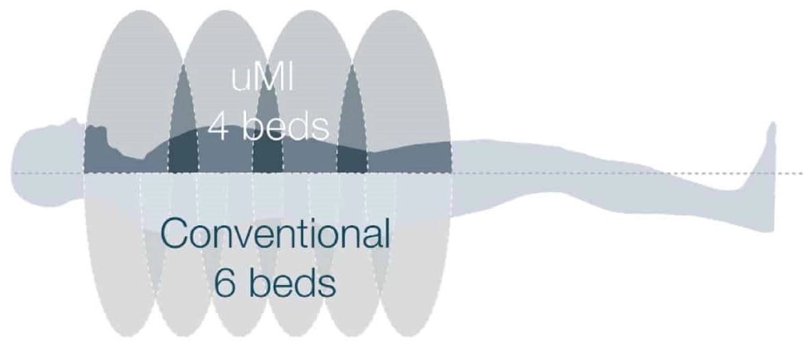 uMI 550 | Digital High-Resolution PET/CT