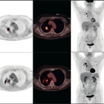 uMI 780 | Ultra-Fast High-Resolution Digital PET/CT