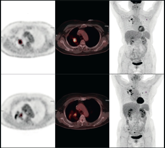 uMI 780 | Ultra-Fast High-Resolution Digital PET/CT