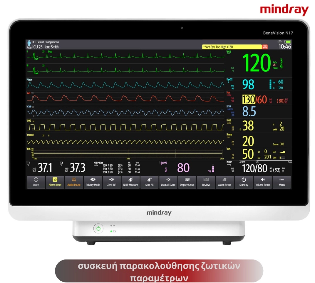 BENEVISION N19 BENEVISION CMS κεντρικός σταθμός