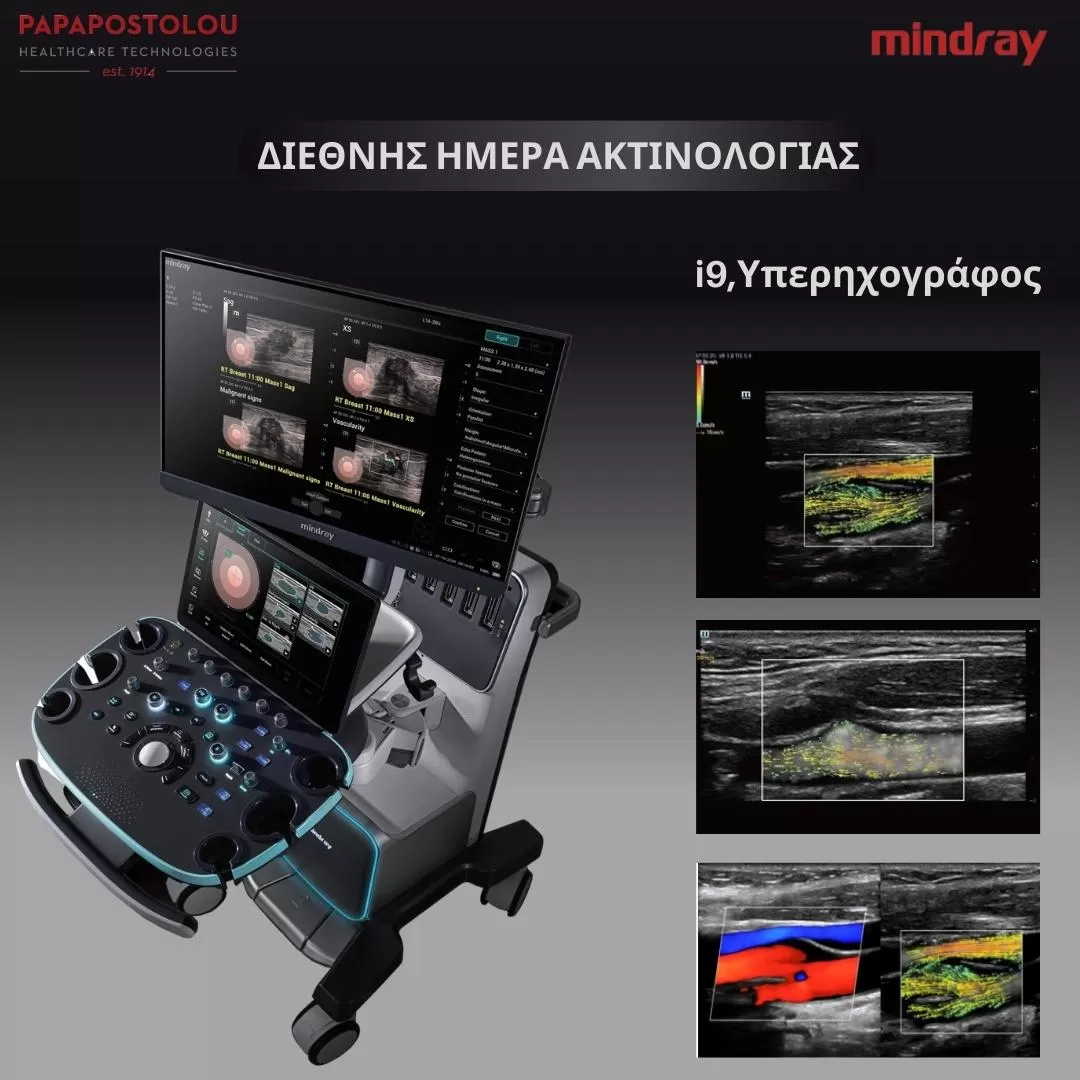i9 υπέρηχος